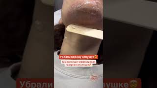 Эффективная лазерная эпиляция с гарантией результата!🧡