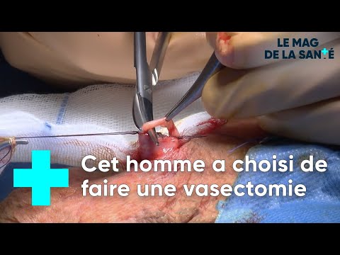 Vidéo: Dans la vasectomie, quelle partie est ligaturée ?