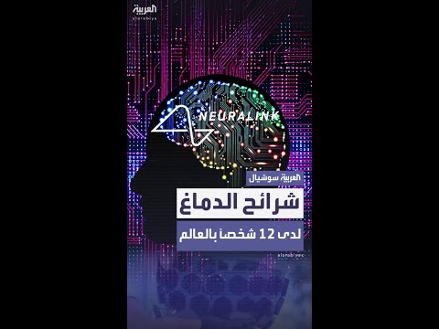 شركة نيورالينك المملوكة لإيلون ماسك جرى زرع شرائح الدماغ لدى 12 شخصا حول العالم