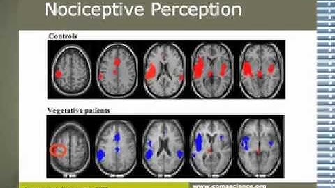 Behavioural, electrophysiological and imaging results in patients with disorders of consciousness