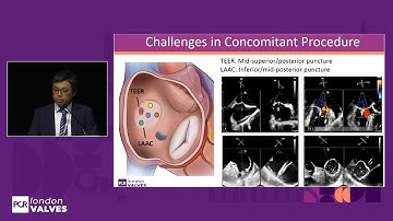 Mastering mitral and tricuspid TEER: clinical strategies in patients with complex anatomy