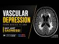 What is Vascular Depression? | The Disconnected Brain Network Explained | FCPS Psychiatry