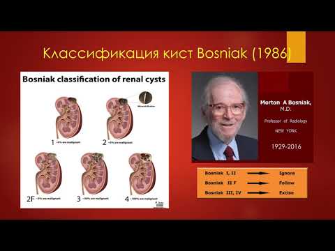 УЗ-диагностика кист почек за 7 минут. УЗИ в урологии-2020 (минисерии) Станислав Феданов