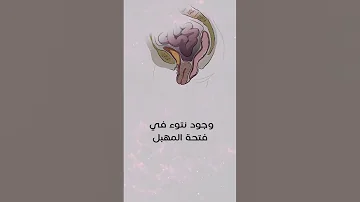 اعراض هبوط الرحم 6 علامات تدل على انك مصابة بتدلي الرحم اسرعي الى الطبيبة النسائية 