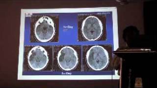 Lecture on  CT Scan MRI at central Hospital Garden Reach screenshot 2