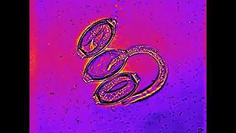 Hatching of egg and release of larvae of 𝘛𝘳𝘪𝘤𝘩𝘶𝘳𝘪𝘴: Micro world: Microorganisms