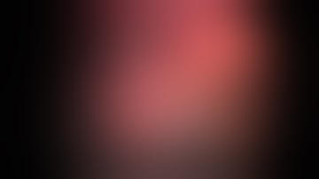 Laparoscopic Component Separation