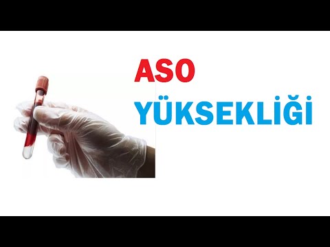 Video: ASO-nu necə etmək olar?