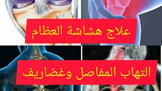 علاج الآلام المفاصل هشاشة العظام ضعف العضلات والغضاريف