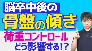 脳卒中後に骨盤傾斜を評価せず歩かせまくる療法士はヤバい。論文から読み解く。