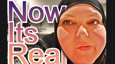 FOODIE BEAUTY DEMONETIZED The Fallout Begins With Canada And Cats. Salah? Syria?