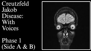 The Vinyl Cat - Creutzfeld Jakob Disease: With Voices [Remastered] - Phase 1 (Full album)