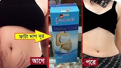 শরীরের যেকোন ফাটা দাগ দূর করুন এই ৪টি ক্রিম ব্যাবহার করে।গর্ভকালীন পেটের ফাটা দাগ।Stretch mark cream