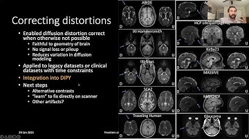 Challenges in diffusion MRI tractography