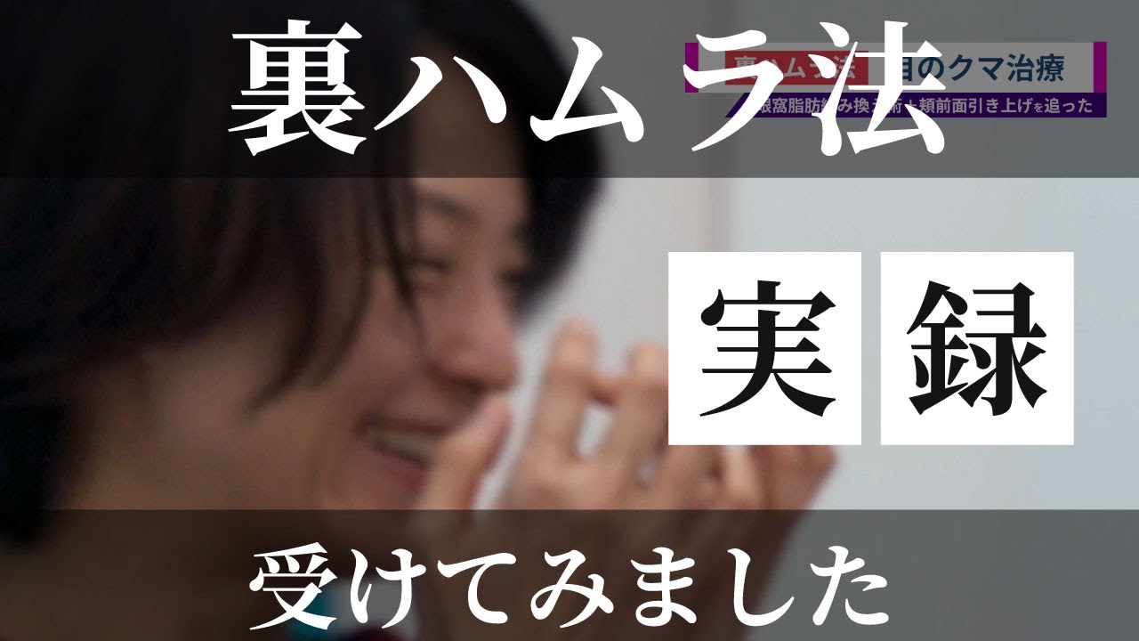 【１年間の実録】目の下の膨らみに悩みんだ４０代主婦がクマ治療（≒裏ハムラ法）に挑戦しました