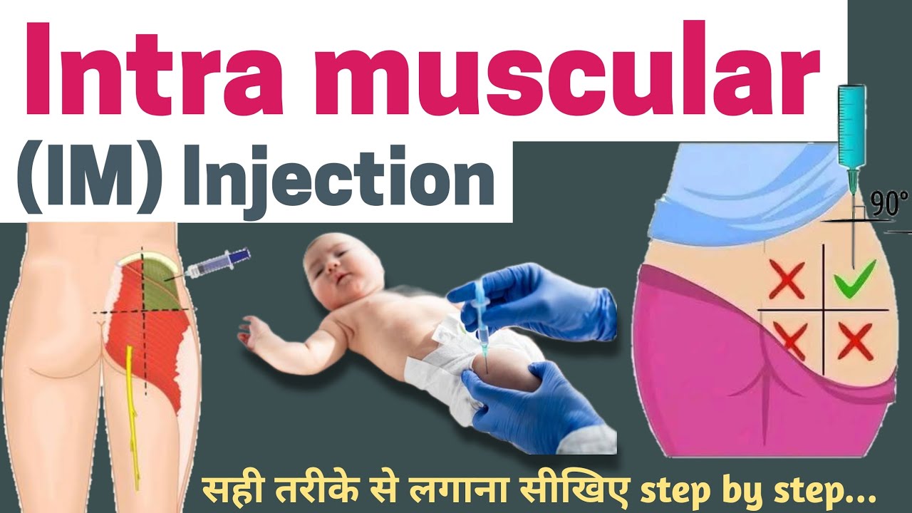 IM Injection technique || Intramuscular || how to give IM injection? # ...