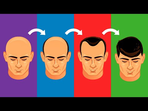 Video: Topp hårproblemer og løsninger