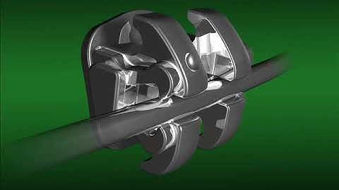 Mắc cài 3M Smartclip Brackets