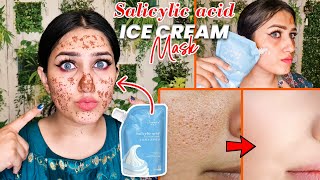 Does This Salicylic Acid ice cream Mask Work? | Salicylic acid ice cream mask