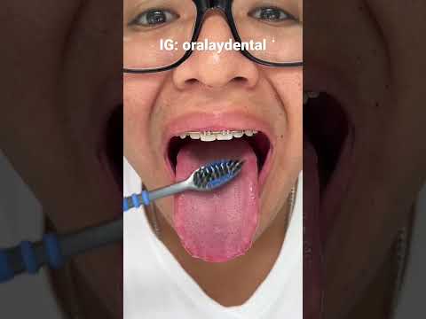 Video: Cómo cepillarse los dientes con un piercing en la lengua: 14 pasos