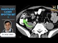 Radiology Cases - Spotters Set 1 : Quiz and Discussion (LIVE)