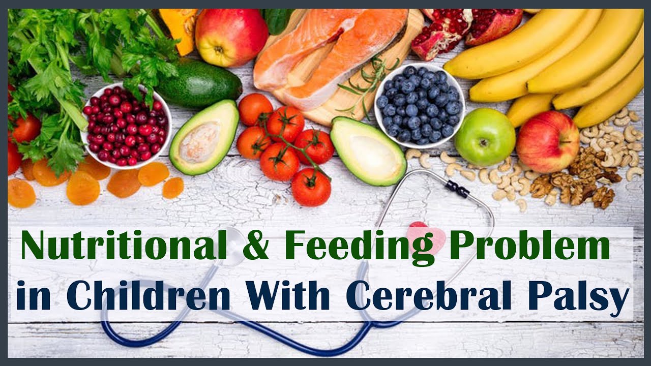 Nutritional & Feeding Problem in Children With Cerebral Palsy Trishla