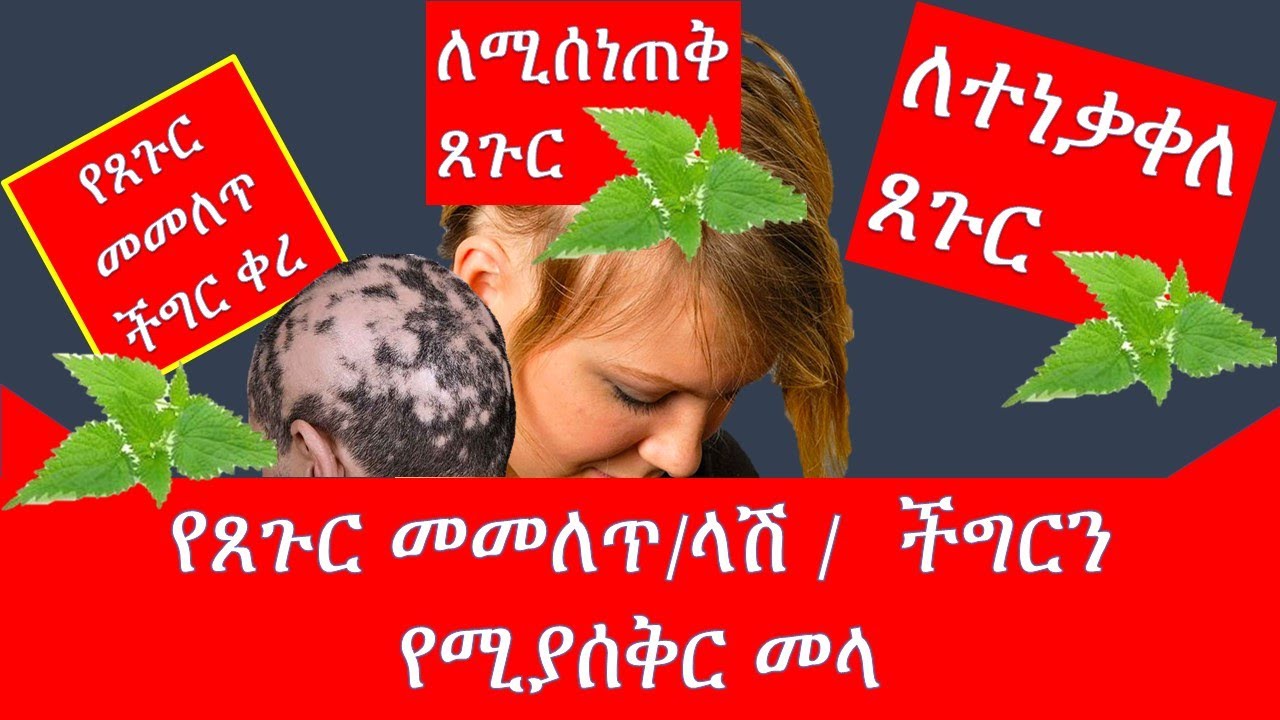 ለጸጉር መመለጥ(ላሽ) ምርጥ መላ / Hair loss or Alopecia //ለጸጉር መነቀል ፣ መሰንጠቅ ምርጥ