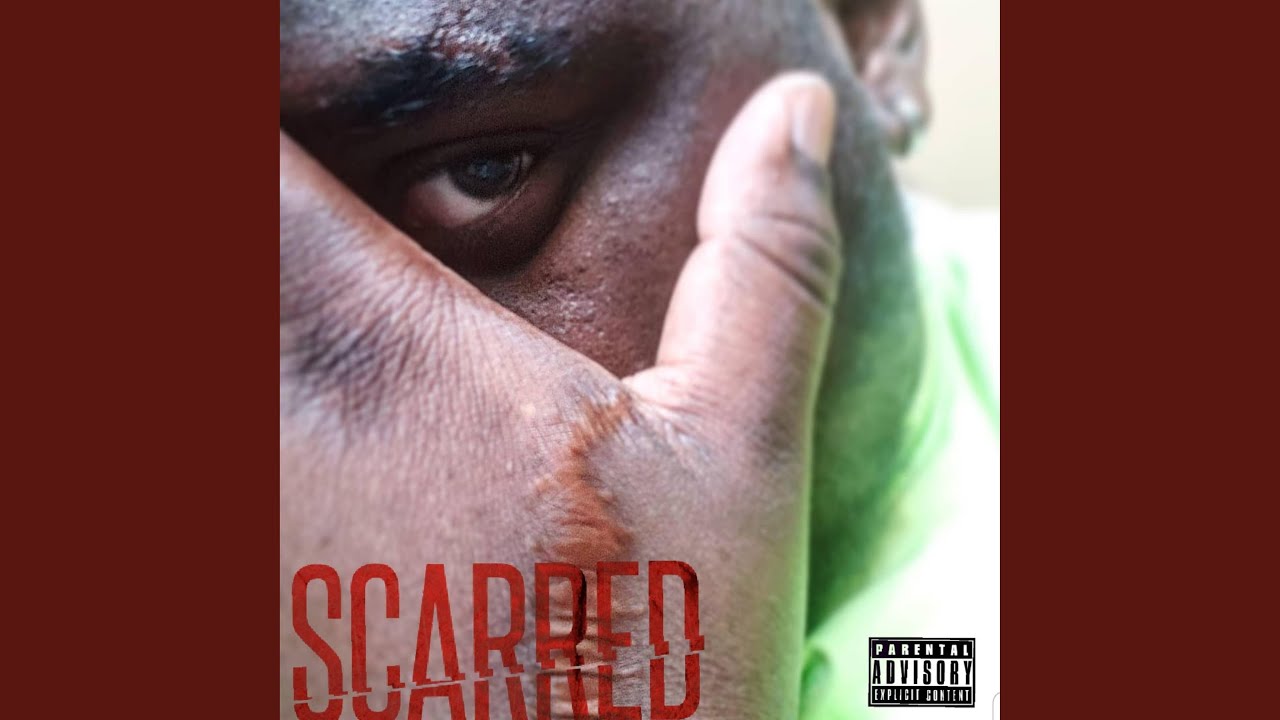 Watch Scarred on YouTube Watch Scarred on YouTube