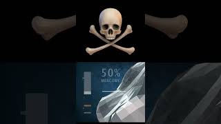 Safe #mercury #amalgam Removal Technique #smart #iaomt #ireland