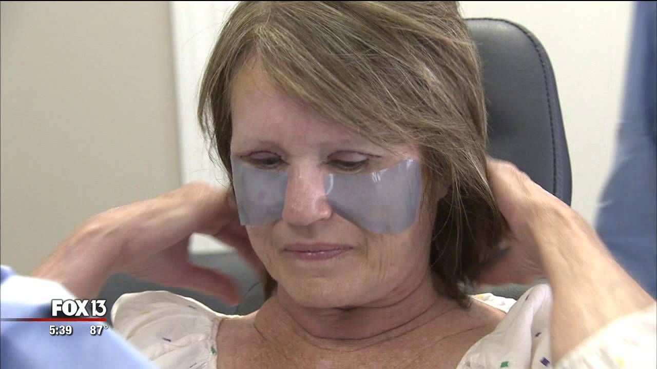 Will Bruising Go Away After Botox