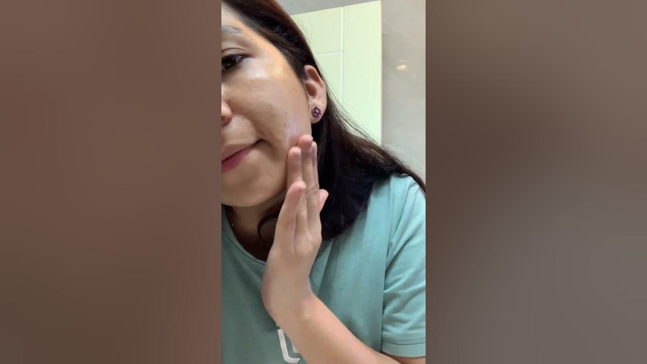 My Acne problem solve in just 1 week 😱 #acneserum #acnetreatment # ...