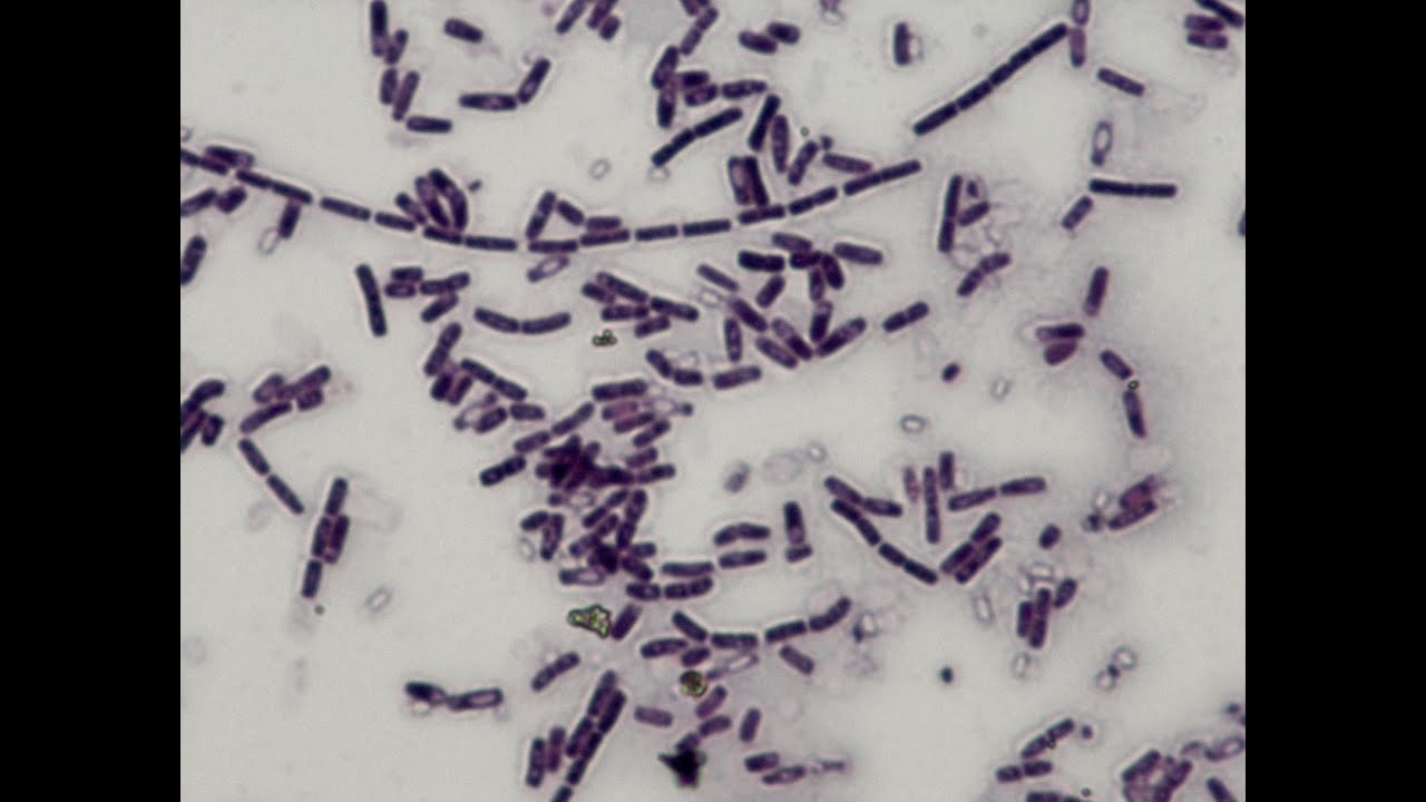 bacillus cereus gram stain