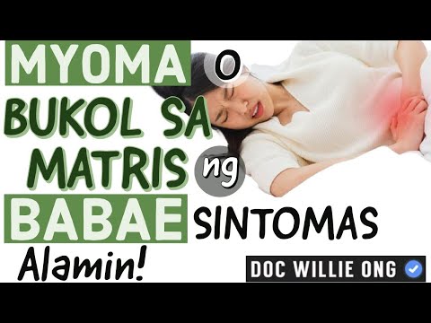 Bukol sa Matris o Myoma - Payo ni Doc Willie Ong #1c