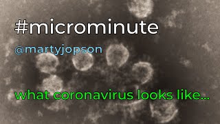 What coronavirus looks like...