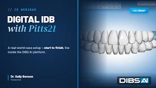 Digital IDB with Pitts21: A Real-World Case Setup