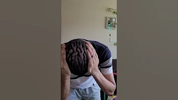 머리에 주름 때문에 눈물 나는 사람들 