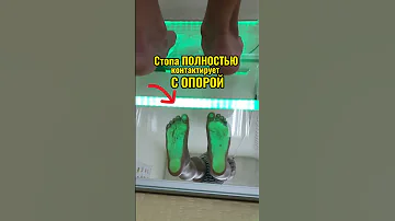 Вальгус САМ НЕ ПРОХОДИТ!