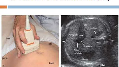 Qui peut prescrire une echographie ?