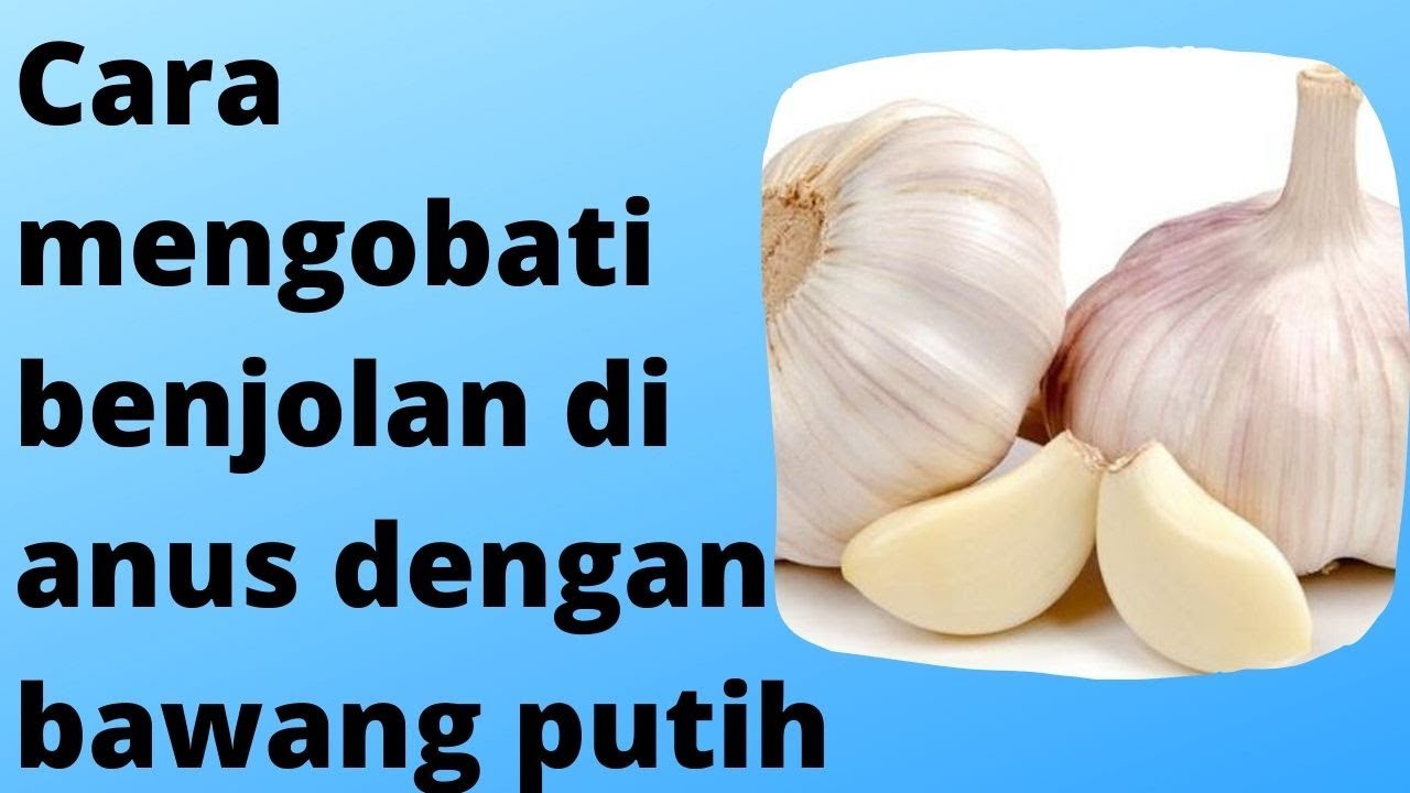 Cara mengobati benjolan di anus dengan bawang putih 