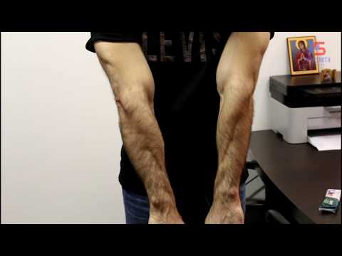 Видео: Бурсит: Лечение на краката, симптоми и причини