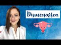 Cólicos menstruales intensos ┃Dismenorrea┃Dolor menstrual ┃Dra. Ana Guajardo ✨