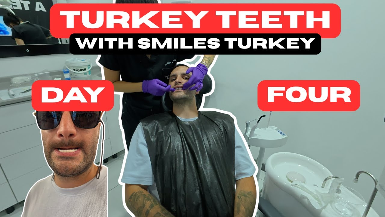 Моя стоматологическая операция в Турции (День 4) | Система All-on-6, временные зубы и корректиров...