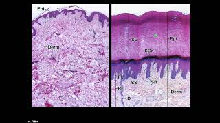 Skin    Part 1