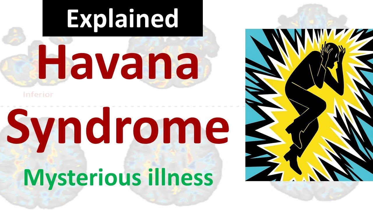 Havana Syndrome Microwave Radiation Suspected In Mysterious Illness On Us Diplomats Abt Gurukul Youtube