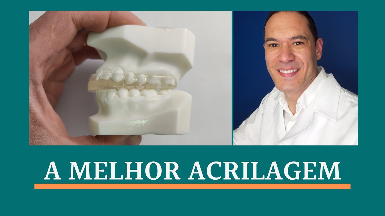 MIORRELAXANTE - Acrilagem com Semi ajustável