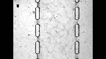 Engineering of functional, perfusable 3D microvascular networks on a chip