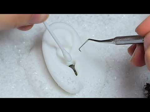 ASMR 꽁꽁 얼어붙은 귀를 녹이는 강력한 귀청소✨ (No Talking) Frozen Ear Cleaning