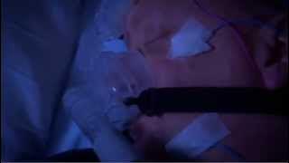 Sleep Disorder Diagnosis - San Francisco