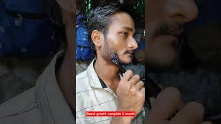 beard growth 🔥🔥#beard #beardgrowth #shortvideos #trending #viral #hairstyle #minoxidil #