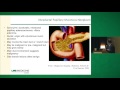 Pancreatic Cysts: Diagnosis & Management